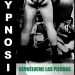 ypnosi-devuelveme-las-piernas
